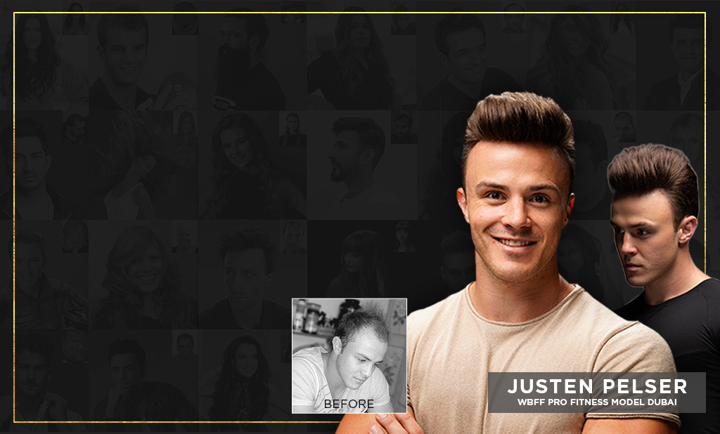 Justen Pelser before and after images